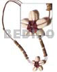 Double Sided Sigay Choker In
